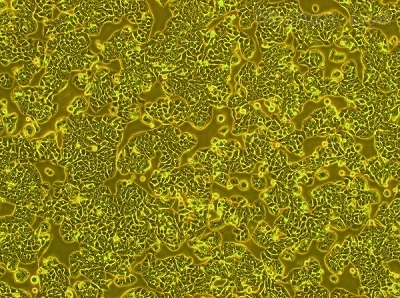 美康生物获得发明专利授权：“一种刺激性促甲状腺激素受体抗体亚型检测试剂盒及其制备方法与应用”