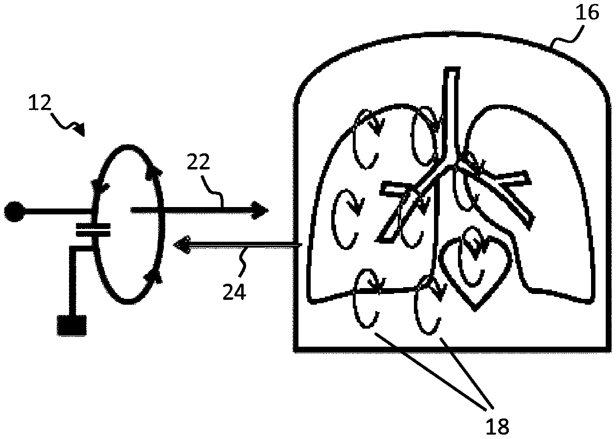 阳光电源获得实用新型专利授权：“电感芯体结构、电感和逆变器”