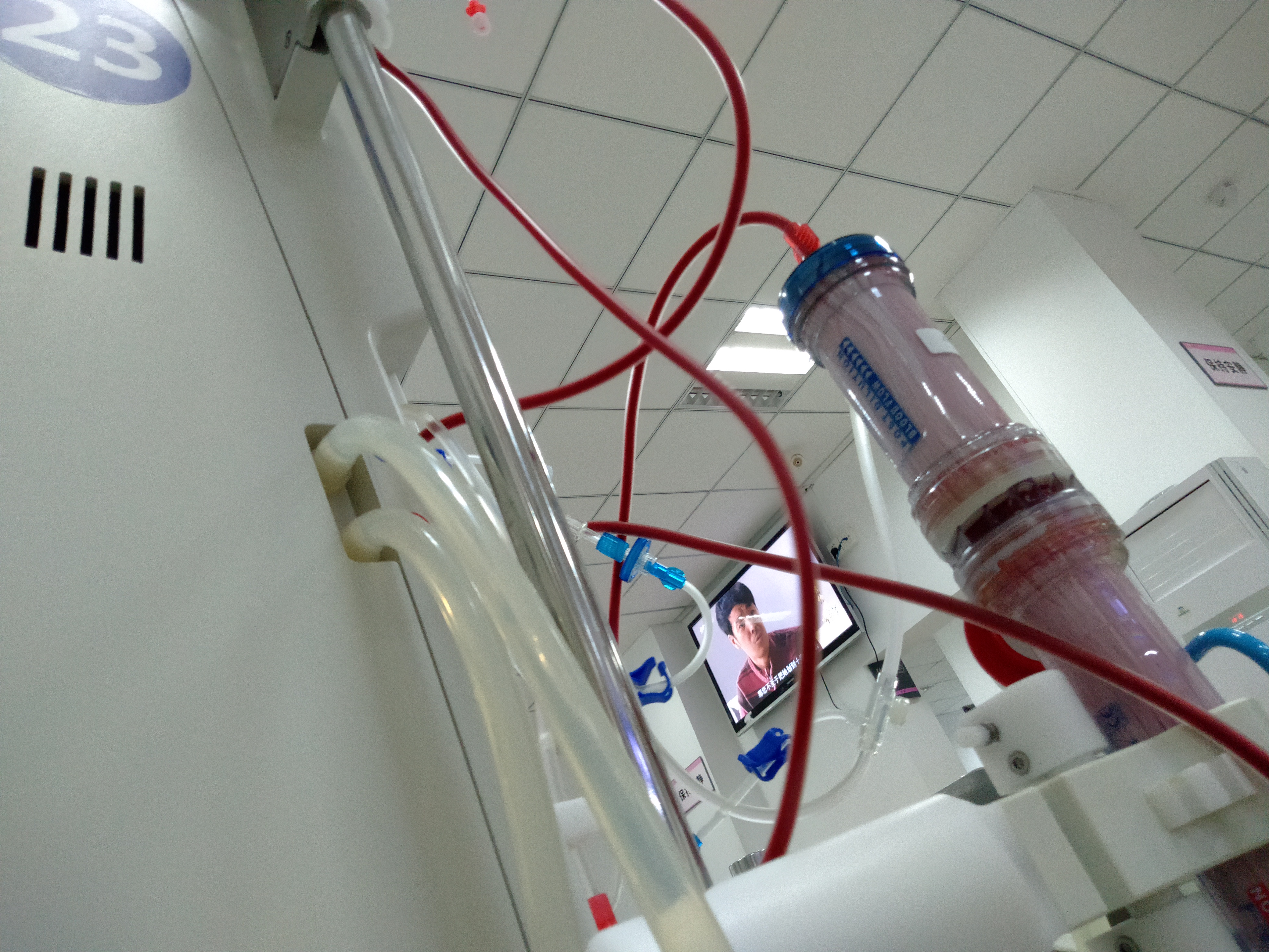 维力医疗(603309.SH)：上半年净利润1.21亿元，同比增长14.17%