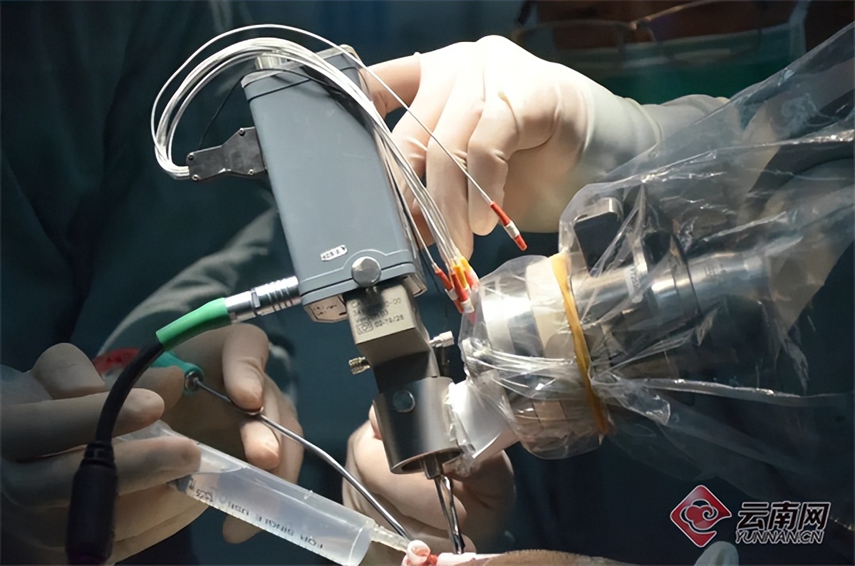 国际医学：开展侵入式脑机接口设备植入手术